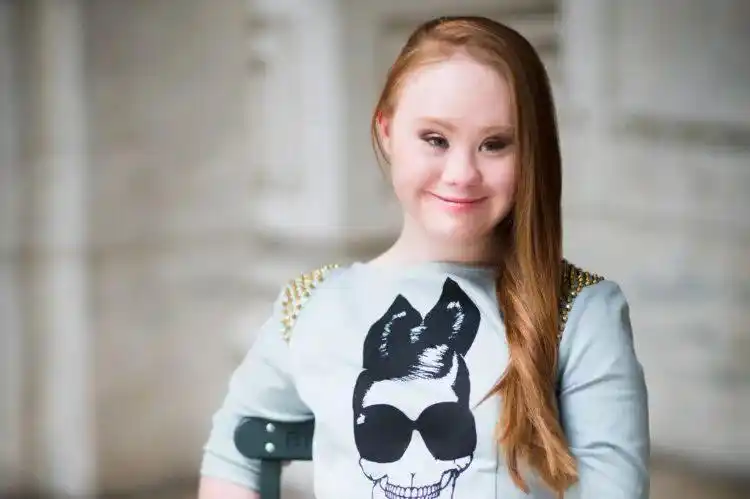 她是一名唐氏综合症患者,有着与常人不甚相同的面容