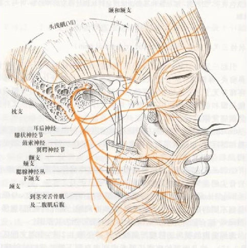 周围性面神经麻痹