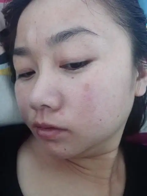 请大家帮我鉴定一下脸上那一小片是黑色素还是斑?