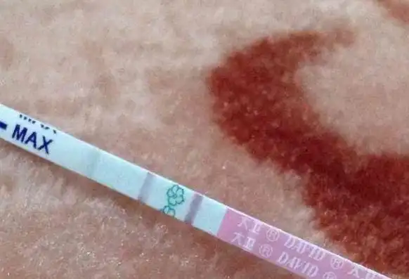 刚怀孕着床出血的图片及特征