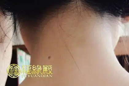 左边脖子后面有痣是靠山吗