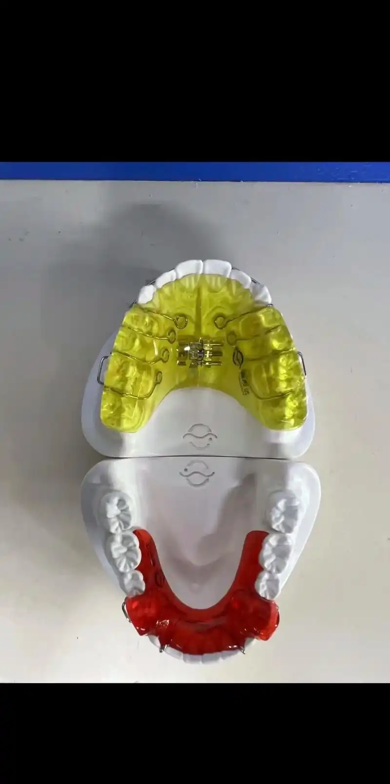 牙齿07 牙齿功能矫正器,矫正牙齿突出,牙缝大,地包天,牙 - 抖音