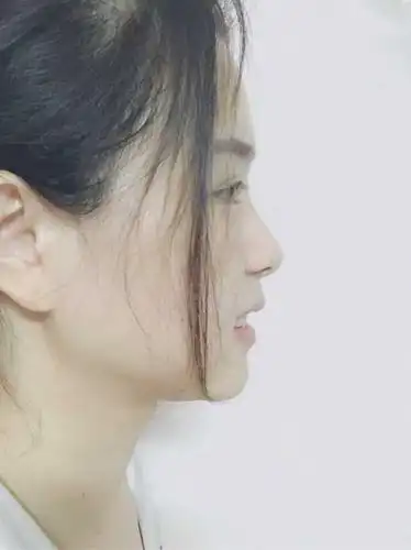 正脸比侧脸好看是怎样一种体验?