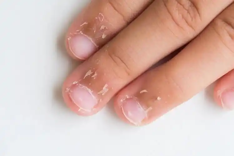 用指甲刀剪掉,免得你看见就想撕丨图虫创意维生素对皮肤健康很重要,但