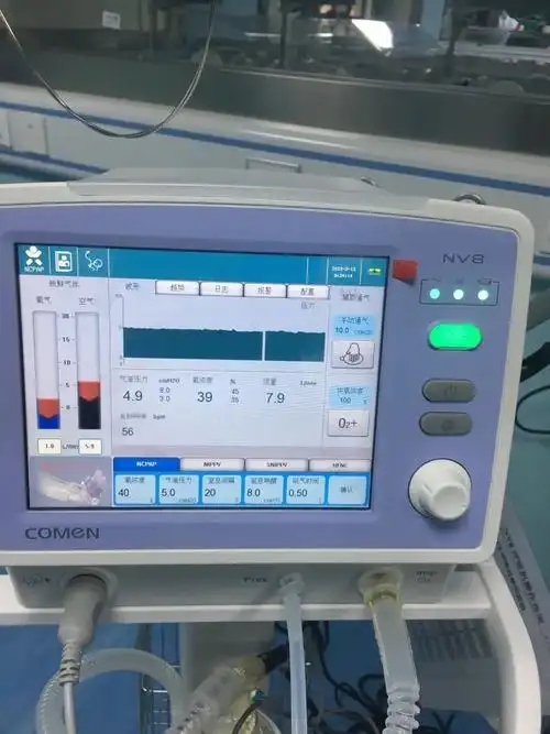上犹人民医院用无创呼吸机及时挽救早产宝宝