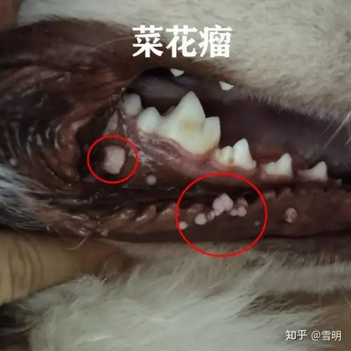 对于这种疾病,学名菜花瘤又叫做乳头状瘤,具有