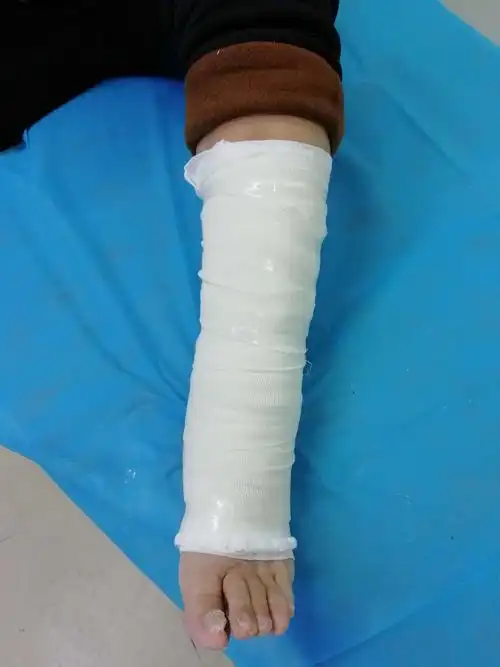 左小腿术后伤口不愈合