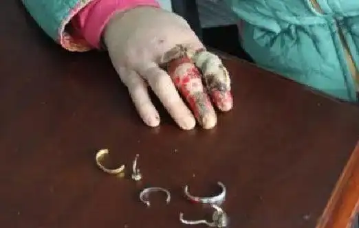 戴戒指打保龄球的图片原图吓人血腥恐怖的后果