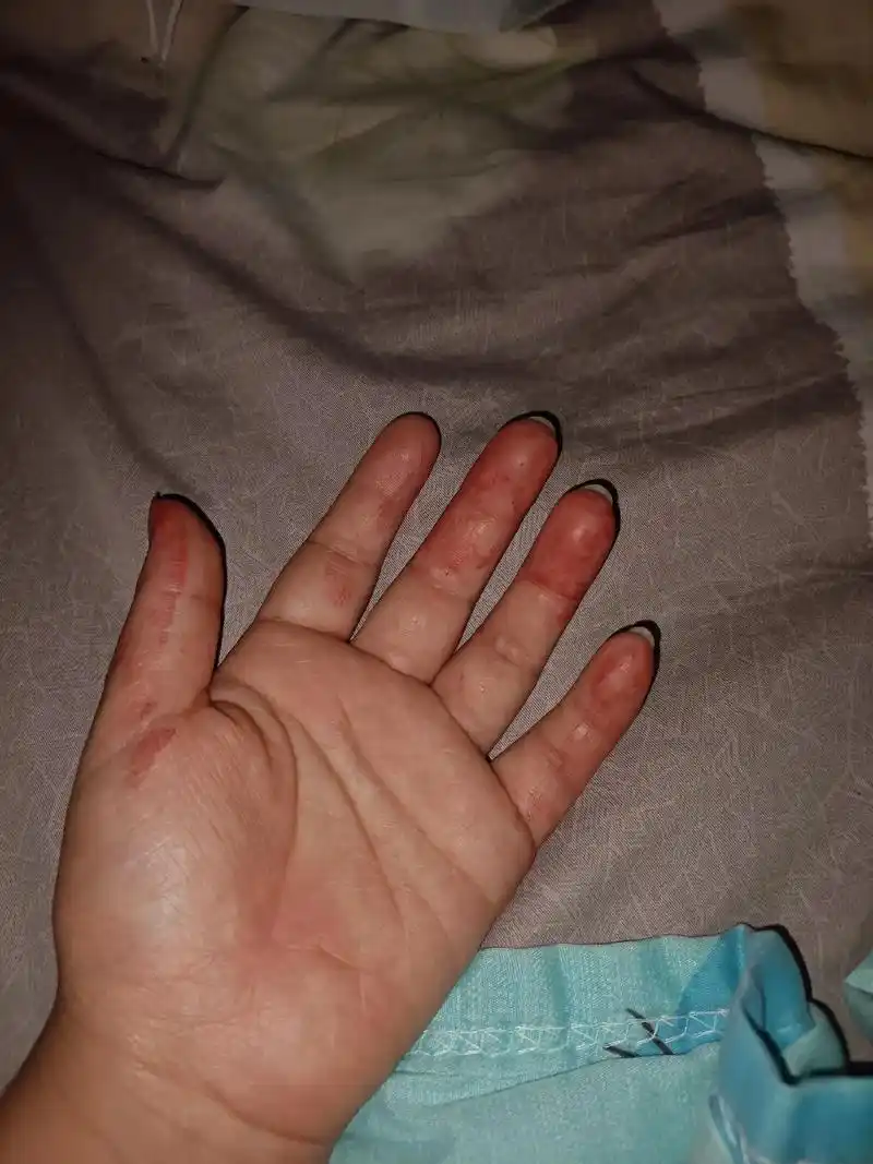 晚上睡觉,儿子突然感到不舒服,我用手摸了一下,一手血,问问你 - 抖音