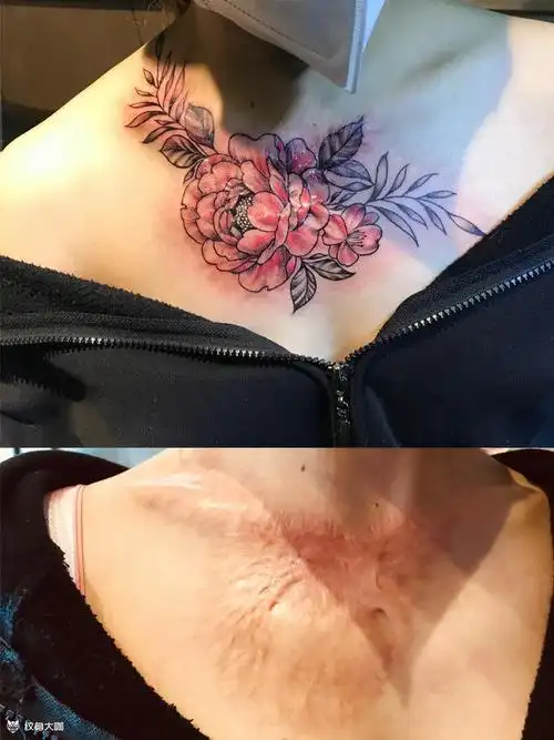 盖疤_纹身图案手稿图片_君刺的纹身作品集