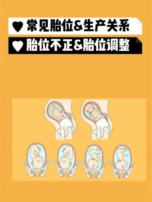 孕中期胎位不正有影响吗