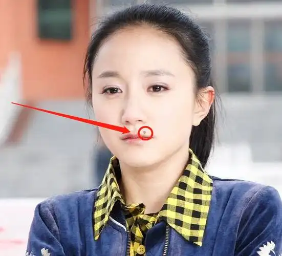 痣长好了还会给演员带来很多的辨识度,让观众一眼就记住你,就像一位