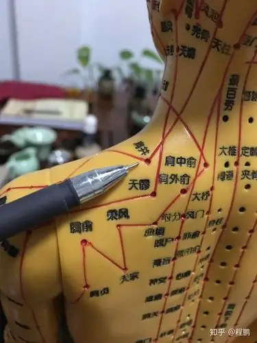 艾灸丨艾灸治疗颈椎病这几个穴位最有效