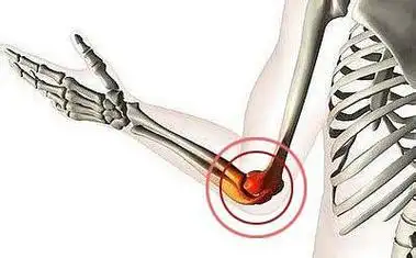深圳正康骨科医院创伤性肘关节炎的饮食调理