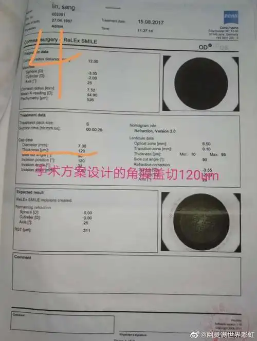 5爱尔眼科篡改检查报告(爱尔前后给的同一份检查报告对不上.