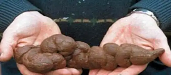 日本人发明恶心粪肉从人粪中提取蛋白质比牛肉贵20倍