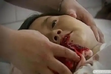 盘点最让人最崩溃的虐童事件