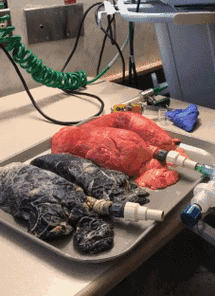 首先,把呼吸机器接到黑色的烟民肺部上,然后这个肺在空气吞吐下,一起