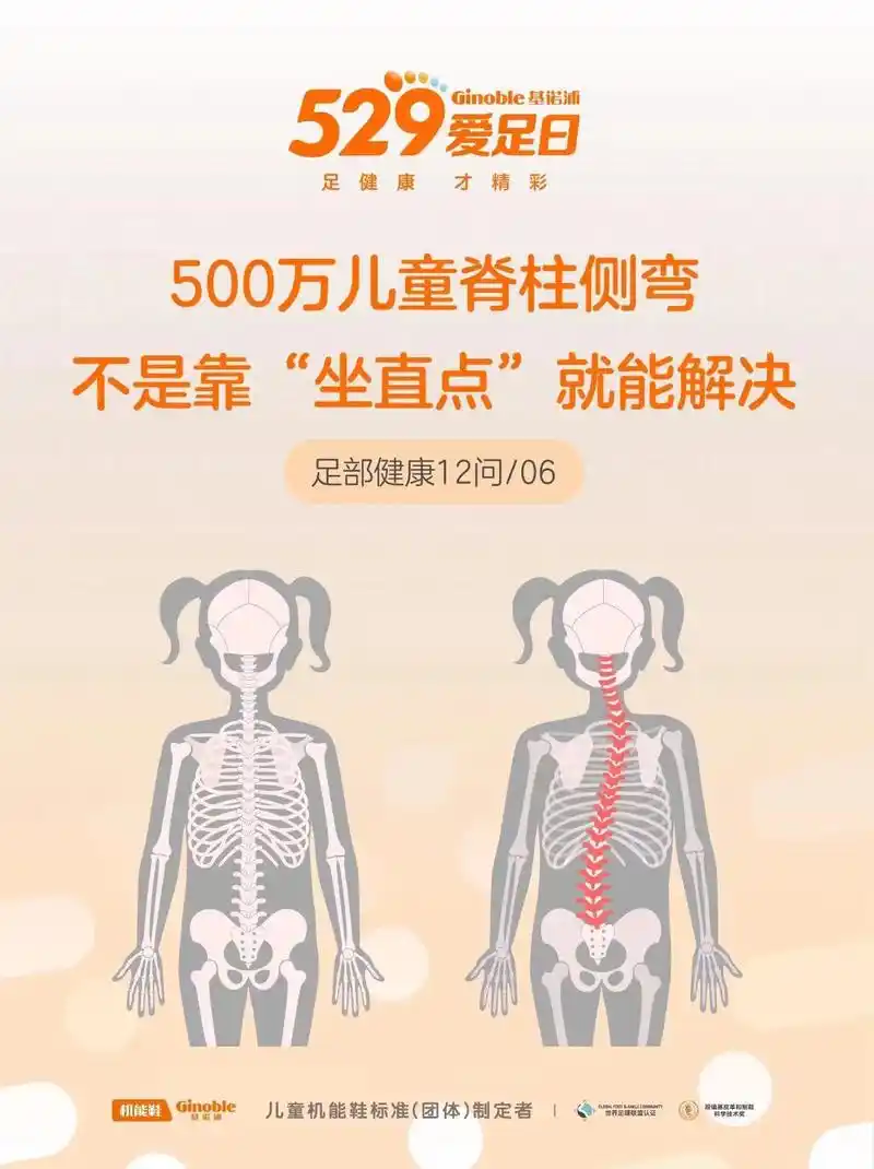 脊柱侧弯,影响儿童健康的大"杀手"75 72《"健 - 抖音