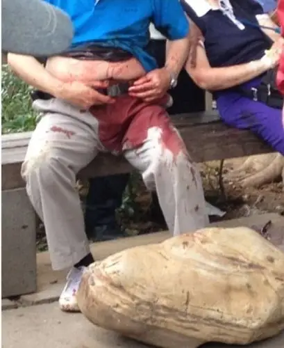 厦门鼓浪屿一男子为争座椅 用刀捅伤4游客