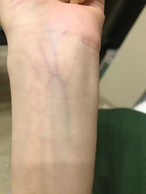 手腕血管看什么皮