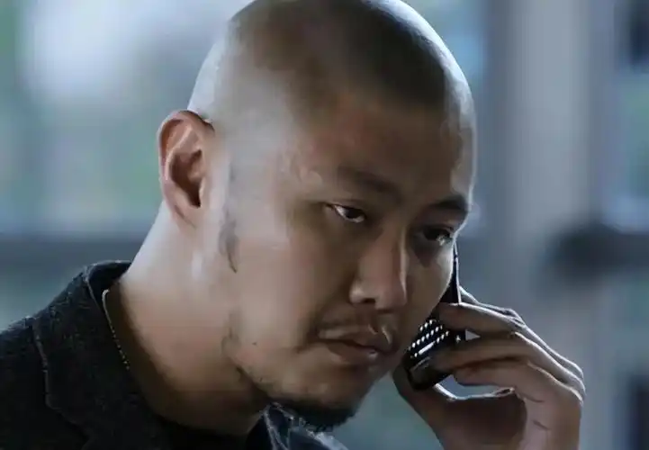 回顾39岁赵荀从李二牛改成花美男他的骨盆用3颗钉子挂在腰上