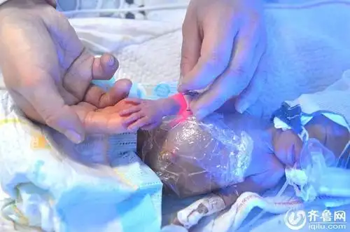 山东菏泽妈妈生下五胞胎 最小孩子0.5公斤
