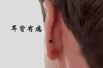 详细分析耳朵有痣的命运好不好左右耳有痣区别很大