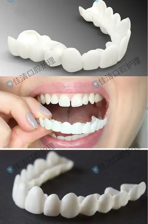 吃饭假牙套仿真缺牙临时牙欧美整牙黄牙牙贴面牙缝防塞牙srk boniu
