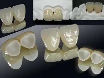 全瓷牙