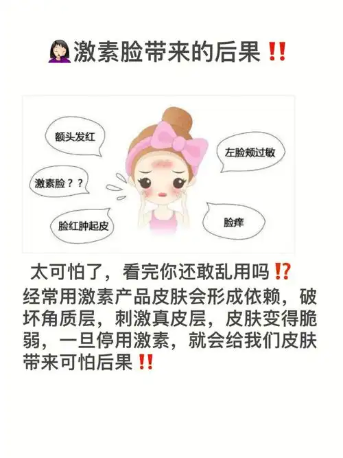 你还不知道滥用药膏后激素脸带来的后果63
