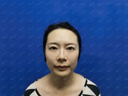 我看了她的脸,五官还是很精致的,真的很好看,但是前提是挡住大额头