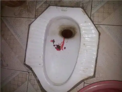 香蕉尤其适合口干烦躁,咽干喉痛者,大便干燥,痔疮,大便带血者,上消化