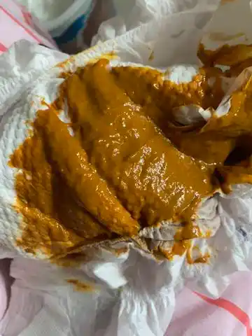 宝宝3个月,3到5天拉一次,这种大便正常吗?