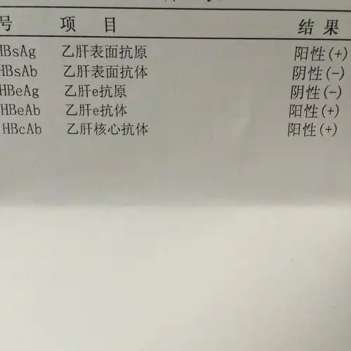 哪位高手帮我亲戚解读这份乙肝化验单?