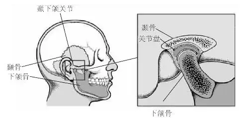 颞下颌关节紊乱综合征为什么会导致张口困难