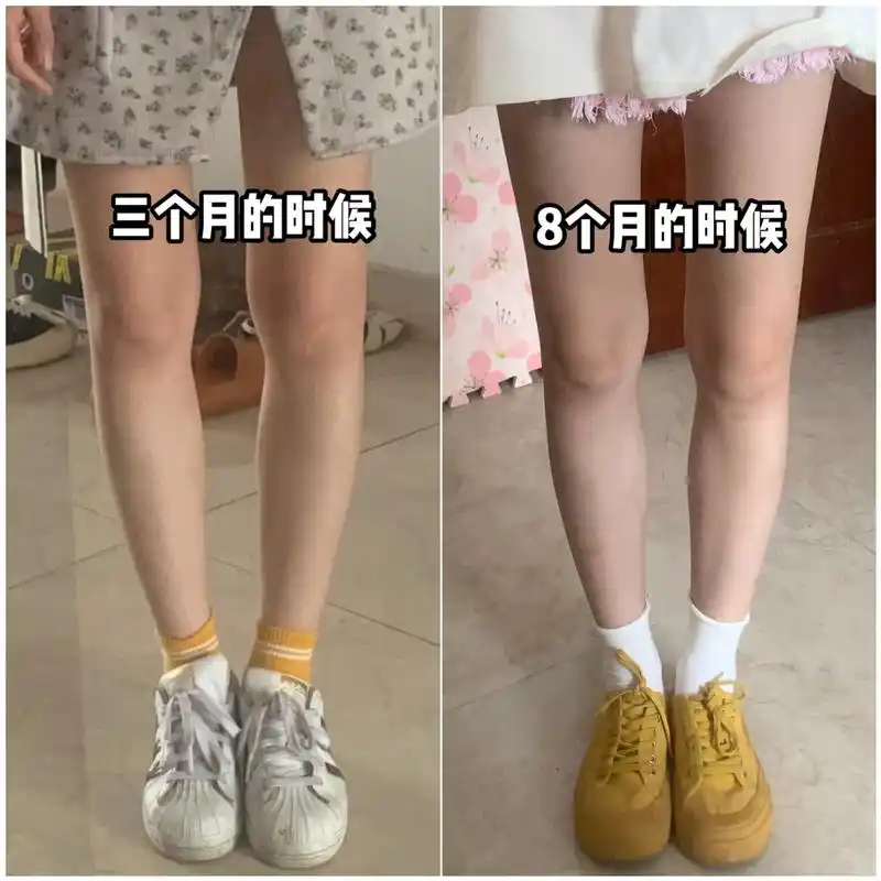 我继续坚持,你们随意.#纠正腿型 #直腿 - 抖音