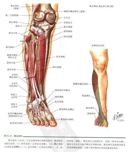 腓神经麻痹的发病原因