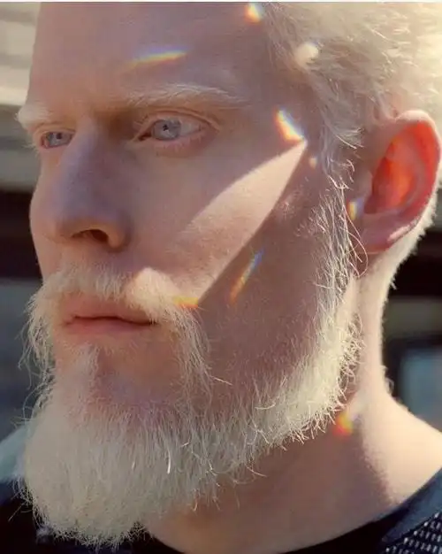 林索伊斯岛人世界上最白的人全身如白雪却不敢以真面目见人