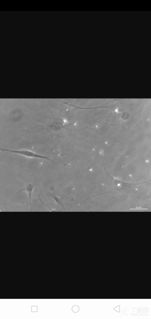 小鼠骨骼肌卫星细胞分离