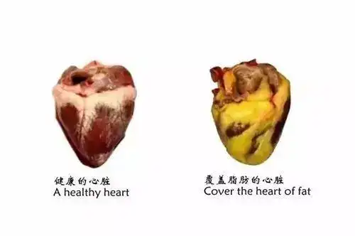 体内脂肪会破坏人体内部的信息传导系统,被脂肪包裹的内脏器官会向