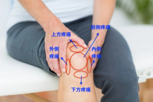 为什么不跑步也会有跑者膝膝盖疼掌握3大要点和跑者膝说拜拜