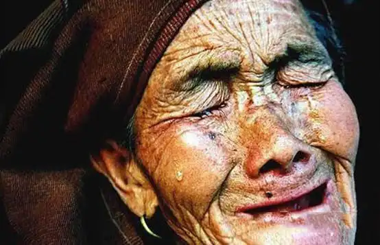 看艾滋病患者如何一步步走向死亡最后一张看了令人绝望