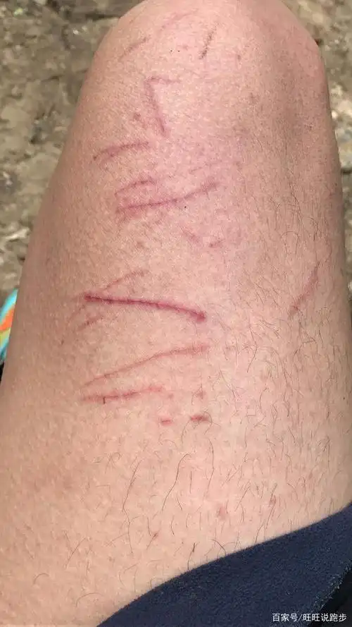 看着都疼,昭通男子跑步到大山包,大腿被划伤也不忘欣赏风景