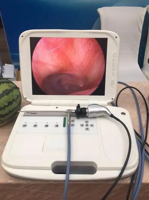 用于鼻外科手术的医用鼻镜内窥镜相机
