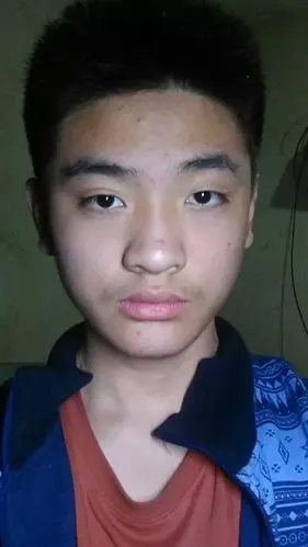 为什么眼睛一个高一个低,一个单,一个双,一个大,一个小,感觉脸两边也