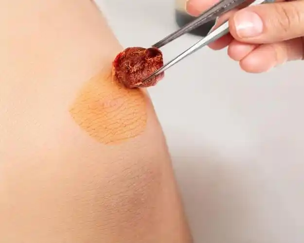 振德碘伏棉球医用消毒皮肤伤口护理酒精棉花家用碘酒消毒液棉花团