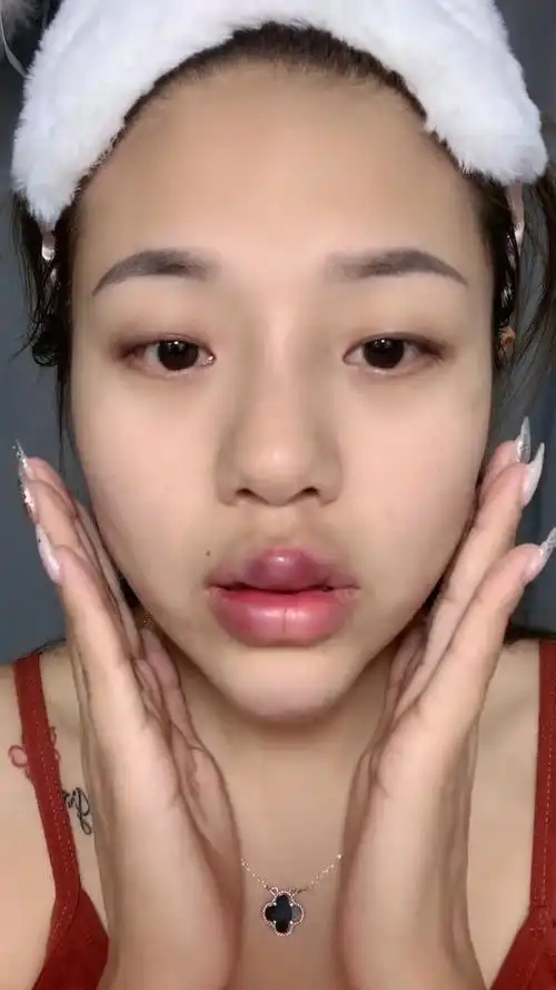 娱乐#小姐姐刚打完嘟嘟唇,瞬间肿成"香肠嘴",这也太坑了吧!-度小视