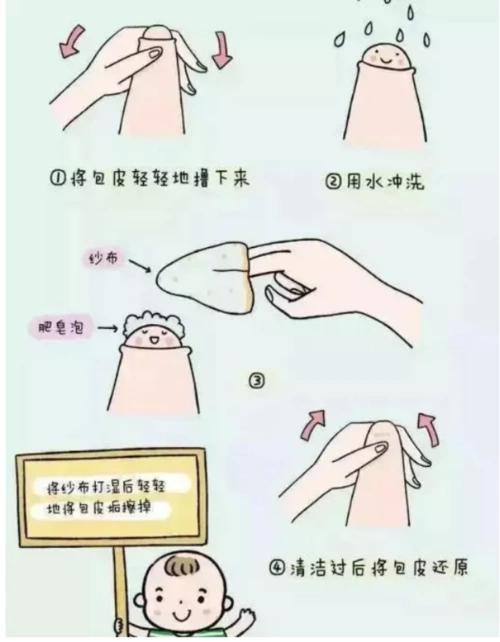 反向撸下来(具体操作可参考下图);家庭版翻包皮教学如果龟头没露出来