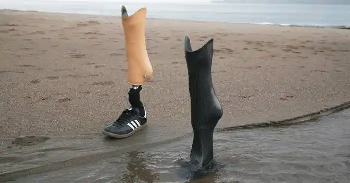 攀岩天才17岁失去双腿,重拾学业自制假肢,依靠科技再攀高峰